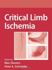 book Critical Limb Ischemia