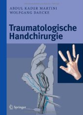 book Traumatologische Handchirurgie