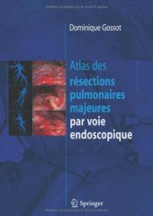 book Atlas des résections pulmonaires majeures par voie endoscopique