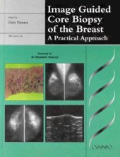 book Image Guided Core Biopsy of the Breast: A Practical Approach