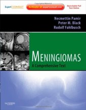 book Meningiomas: Expert Consult - Online and Print (Expert Consult Title: Online + Print)