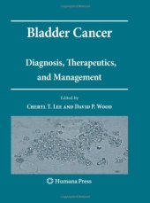 book Bladder Cancer: Diagnosis, Therapeutics, and Management