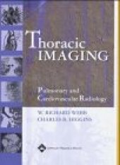 book Thoracic Imaging: Pulmonary and Cardiovascular Radiology