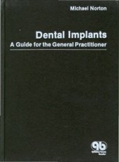 book Dental Implants: A Guide for the General Practitioner