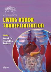 book Living Donor Transplantation