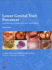 book Lower Genital Tract Precancer: Colposcopy, Pathology and Treatment, 2nd edition