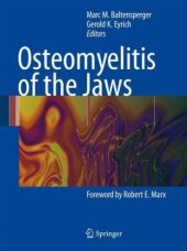 book Osteomyelitis of the Jaws