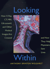 book Looking Within: How X-Ray, CT, MRI, Ultrasound, and Other Medical Images Are Created, and How They Help Physicians Save Lives