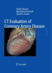 book CT Evaluation of Coronary Artery Disease