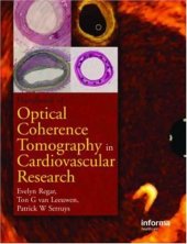 book Optical Coherence Tomography in Cardiovascular Research