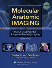 book Molecular Anatomic Imaging: PET-CT and SPECT-CT Integrated Modality Imaging, 2nd Edition