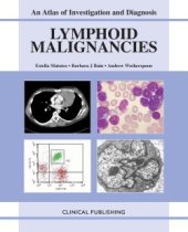 book Lymphoid Malignancies: An Atlas of Investigation and Management