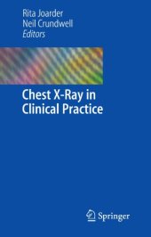 book Chest X-Ray in Clinical Practice