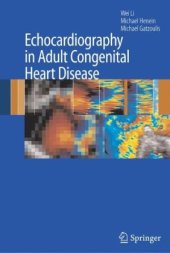 book Echocardiography in Adult Congenital Heart Disease