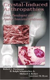 book Crystal-Induced Arthropathies: Gout, Pseudogout and Apatite-Associated Syndromes