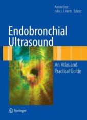 book Endobronchial Ultrasound: An Atlas and Practical Guide