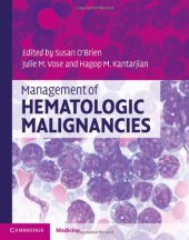 book Management of Hematologic Malignancies