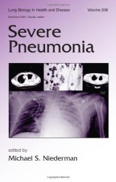 book Severe Pneumonia (Lung Biology in Health and Disease, Volume 206)