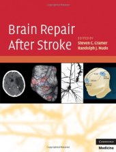 book Brain Repair After Stroke