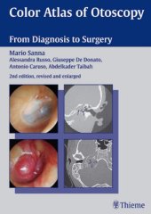 book Color atlas of otoscopy: from diagnosis to surgery