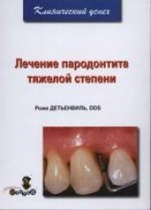 book Лечение пародонтита тяжелой степени