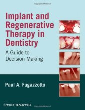 book Implant and Regenerative Therapy in Dentistry: A Guide to Decision Making  