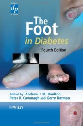 book The Foot in Diabetes, 4th Edition  