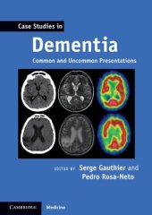 book Case Studies in Dementia: Common and Uncommon Presentations (Case Studies in Neurology)  