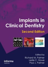 book Implants in Clinical Dentistry, Second Edition  