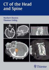 book CT of the Head and Spine  