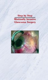 book Step by Step Minimally Invasive Glaucoma Surgery  