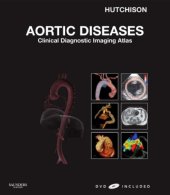 book Aortic Diseases: Clinical Diagnostic Imaging Atlas (Cardiovascular Emergencies: Atlas and Multimedia)  