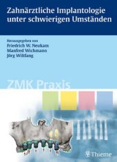 book Zahnärztliche Implantologie unter schwierigen Umständen (ZMK Praxis)  