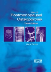 book Atlas of Postmenopausal Osteoporosis, 3rd Edition  