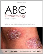 book ABC of Dermatology, 5th Edition (ABC Series)  