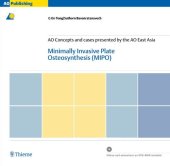 book Minimally Invasive Plate Osteosynthesis (MIPO)  