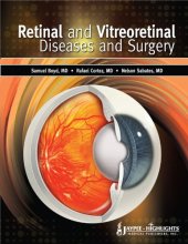 book Retinal and Vitreoretinal Diseases and Surgery  