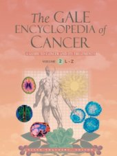 book The Gale Encyclopedia of Cancer, volume 2  