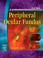 book Peripheral Ocular Fundus, Third Edition  