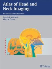 book Atlas of Head and Neck Imaging : The Extracranial Head and Neck  