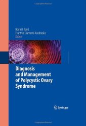 book Diagnosis and Management of Polycystic Ovary Syndrome    