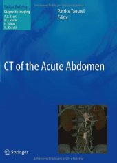 book CT of the Acute Abdomen 