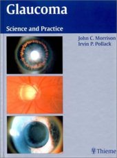book Glaucoma. Science and Practice