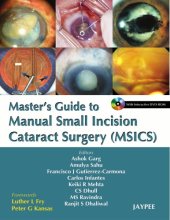 book Master's Guide to Manual Small Incision Cataract Surgery