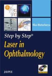 book Step by Step Laser in Ophthalmology