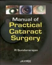 book Manual of Practical Cataract Surgery