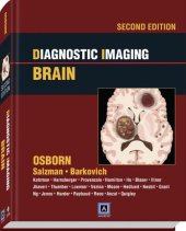 book Diagnostic Imaging: Brain