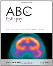 book ABC of Epilepsy