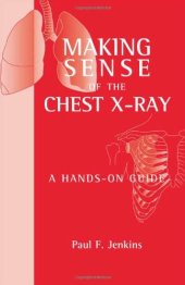 book Making Sense of the Chest X-ray: A Hands-on Guide (Hodder Arnold Publication)