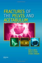 book Fractures of the Pelvis and Acetabulum